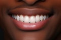 Professional odontic clinical work. Close-up of a black man with perfectly white teeth.