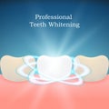 Professional Teeth Whitening background