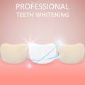 Professional Teeth Whitening, Healthy Tooth and yellow teeth,