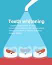Professional teeth whitening vector illustration