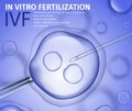 Professional In Vitro Fertilisation Process Banner