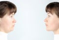Profile of female face with and without a second chin, concept before and after plastic surgery