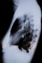 Profile XRay of a woman`s chest