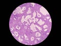 Prostat cells