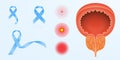 Prostate cancer color icon. Men s reproductive system disease. Male infertility and genital problem. Groin pain