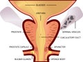 Prostate, an exocrine gland of the male reproductive system. Within it sits the urethra coming from the bladder which is called