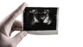 Prostate ultrasound scan on isolated white background, picture of the prostate at the doctor`s hand. Prostata place for text Royalty Free Stock Photo