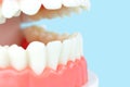 Prosthetic dentistry. Advertising. Removable denture. Dentist appointment Dental teeth model. Open human upper and lower. Royalty Free Stock Photo