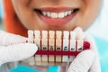 Prosthetic dentistry. Matching colour of the tooth enamel with whitening chart. Dentistry conceptual photo. Prosthetic dentistry Royalty Free Stock Photo