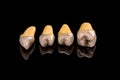 Prosthetic teeth