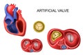 Prosthetic tricuspid heart valve