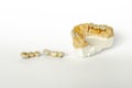 Prosthetics for missing teeth. false teeth. ceramic-metal dental bridges. gypsum model of the upper jaw. aesthetic prosthetics