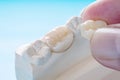 Prosthodontics or Prosthetic Royalty Free Stock Photo