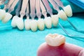 Prosthodontics or Prosthetic Royalty Free Stock Photo