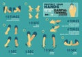 Protect your Hands before to be Carpal tunnel syndome,infographic elements - Vector flat design