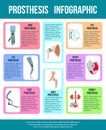 Prothesis Flat Infographic Banner Royalty Free Stock Photo