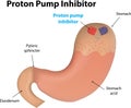 Proton Pump Inhibitor Royalty Free Stock Photo