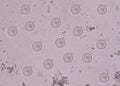 Protozoa in stool exam.