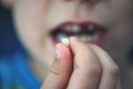 Proud young boy age 6 holds his falling milk teeth. Childhood healthcare concept. Real people