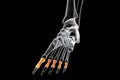 Proximal phalanges of the foot, 3D illustration