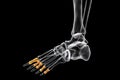 Proximal phalanges of the foot, 3D illustration