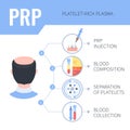 PRP hair regrowth therapy infographics for men Royalty Free Stock Photo