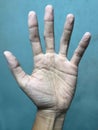 Pruney hand due to long soaking in the water. HandÃ¢â¬â¢s skin shrinking