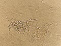 Pseudohyphae and budding yeast cells