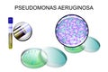 Pseudomonas aeruginosa. bacterial inoculation