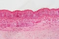 Pseudostratified epithelium is a type of epithelium that