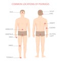 Psoriasis illness diagram