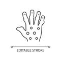 Psoriatic arthritis linear icon Royalty Free Stock Photo