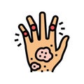 psoriatic arthritis skin health problem color icon vector illustration Royalty Free Stock Photo