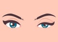 Ptosis of the upper eyelid, optical problem with eye, medical vector illustration Royalty Free Stock Photo