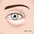 Puffy eye bag close up of aging woman`s face, illustration