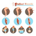 Pulled Muscle Royalty Free Stock Photo