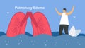 Pulmonary edema is symptom that lungs fill with fluid. Other names is lung congestion, lung water, and pulmonary congestion. Ã Â¸Âº