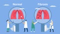 Pulmonary fibrosis is a part of restrictive lung disease. Lung tissue becomes damaged and scarred. Comparison of normal and bad