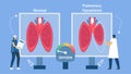 Pulmonary hypoplasia is incomplete  of lungs. It causes low size of alveoli. Pulmonology about restrictive lung disease Royalty Free Stock Photo