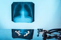 Pulmonary tuberculosis treatment concept. Medical still life pills stethoscope x-ray