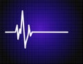 Pulse EKG (ECG)