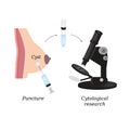 Puncture of cysts in the breast. Cytological