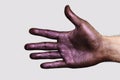 Purple Hand showing five Fingers