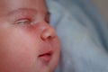 The purulent eye processed by tetracycline ointment Conjunctivitis, treatment of the newborn Royalty Free Stock Photo