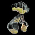 Purulent inflammation of frontal, maxillary, and ethmoid sinuses, close-up view