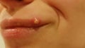 Purulent large pimple on the lip of a woman. A sick sore on the human body. Ugliness inspection