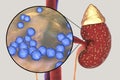 Pyelonephritis, medical concept, and close-up view of bacteria, the common causative agent of kidney infection