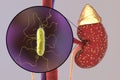 Pyelonephritis, medical concept, and close-up view of bacteria