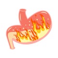 Pyrosis stomach. Medical illustration. Fire inside stomach vector