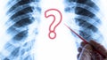 The question of health or lung disease. Medical concept. Hand in glove with a red pointer on the background of chest X-ray. Royalty Free Stock Photo